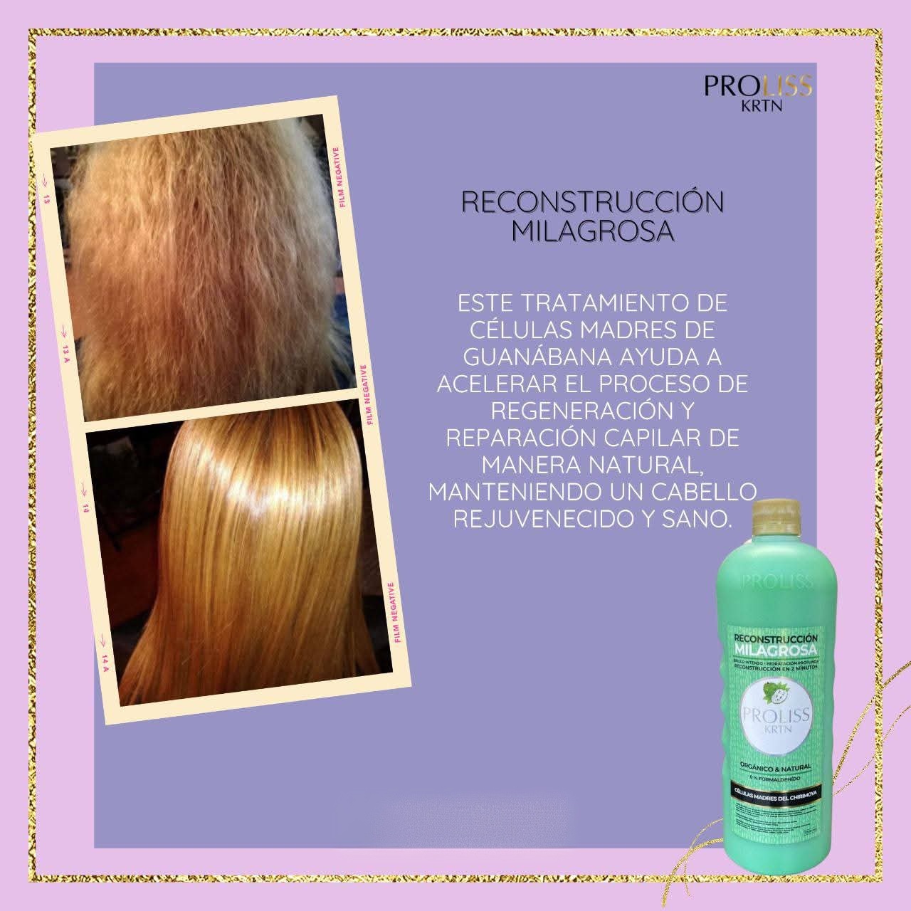 Milagrosa proliss - Imagen 3